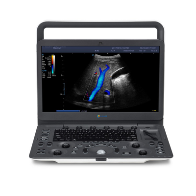 Color Doppler  EC2