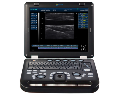 B/W Ultrasound    EC50A